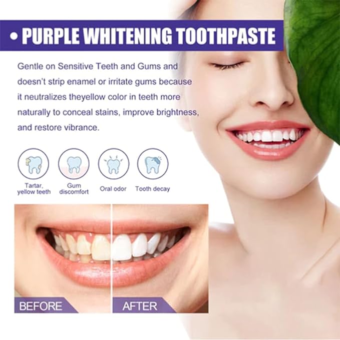 Purple Whitening Toothpaste | معجون الأسنان الأرجواني لتبييض الأسنان